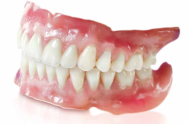 Răng giả: Điều bạn nên biết
