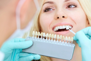 Bạn nên chọn phương pháp làm trắng răng nào?